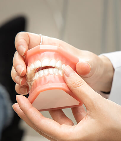 In-house clear aligners